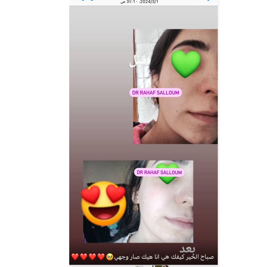 product img