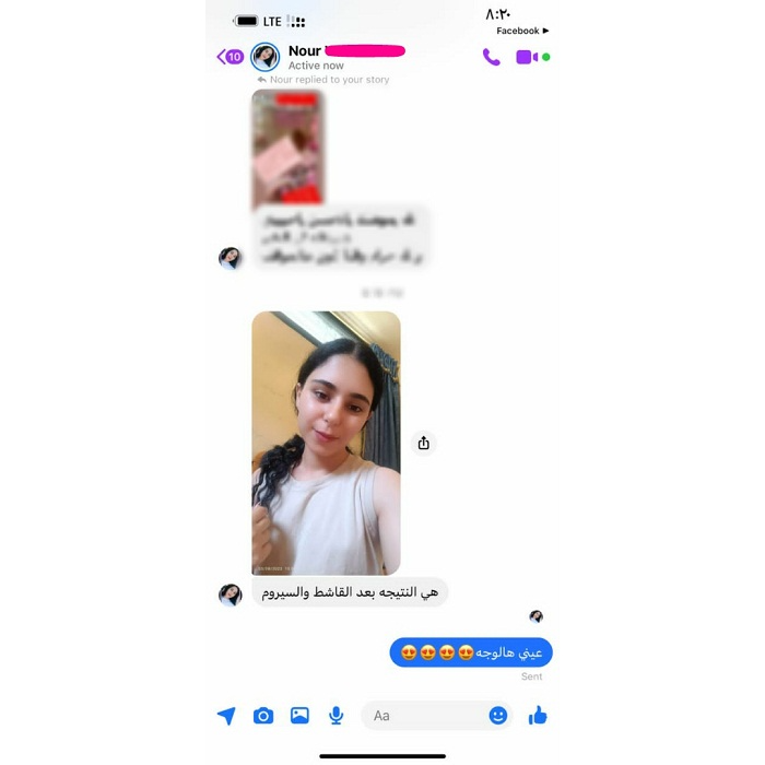 product img