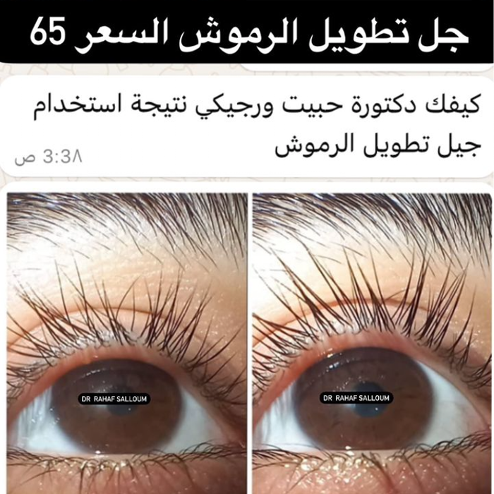 product img