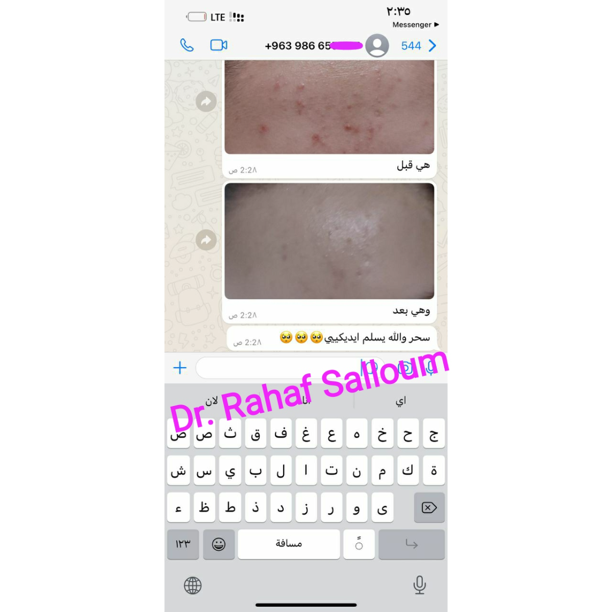 product img