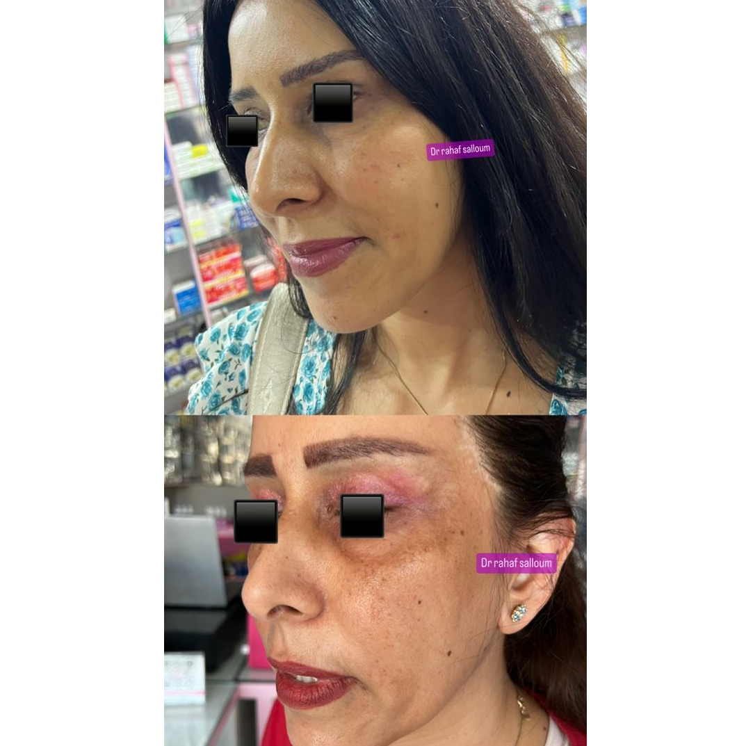 product img