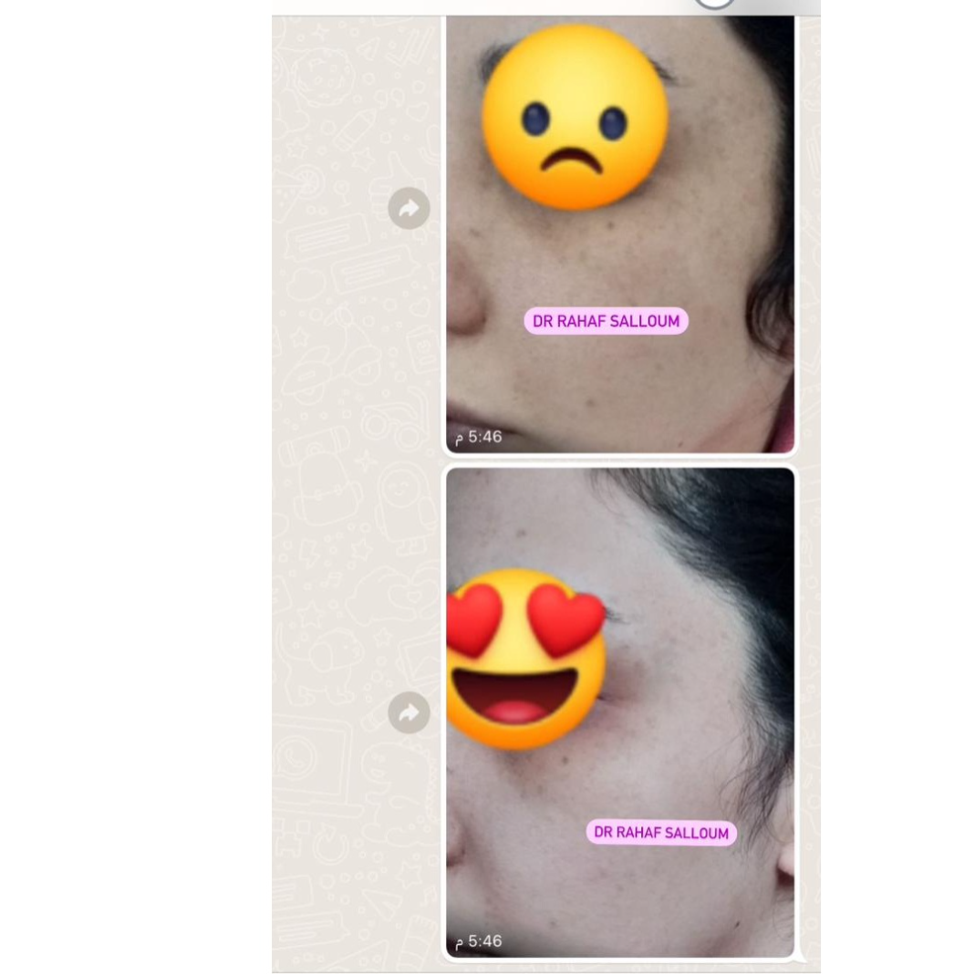 product img