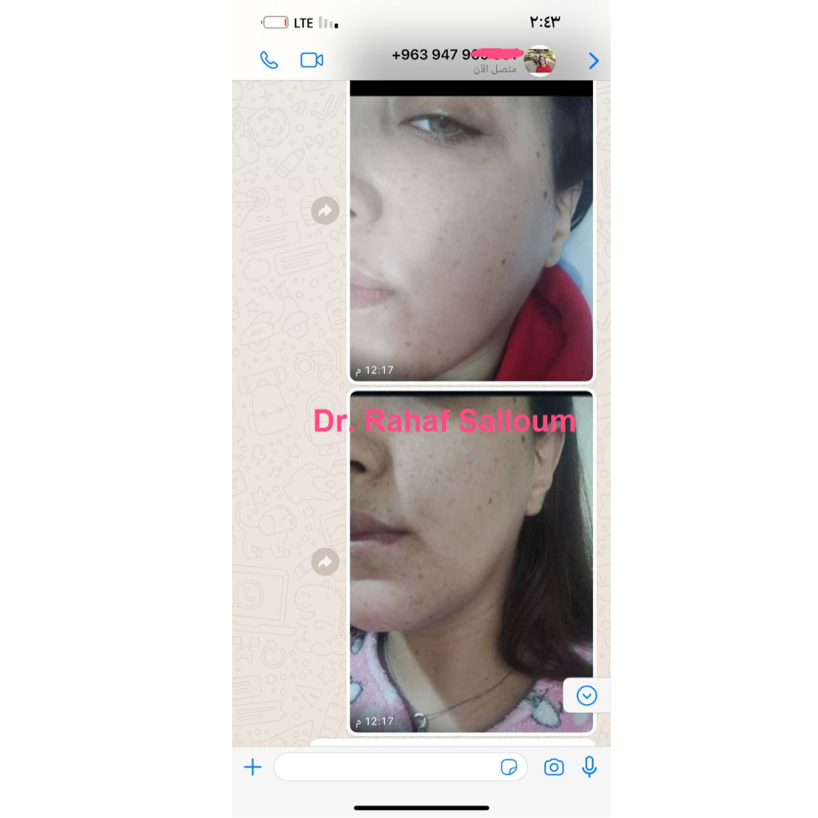 product img