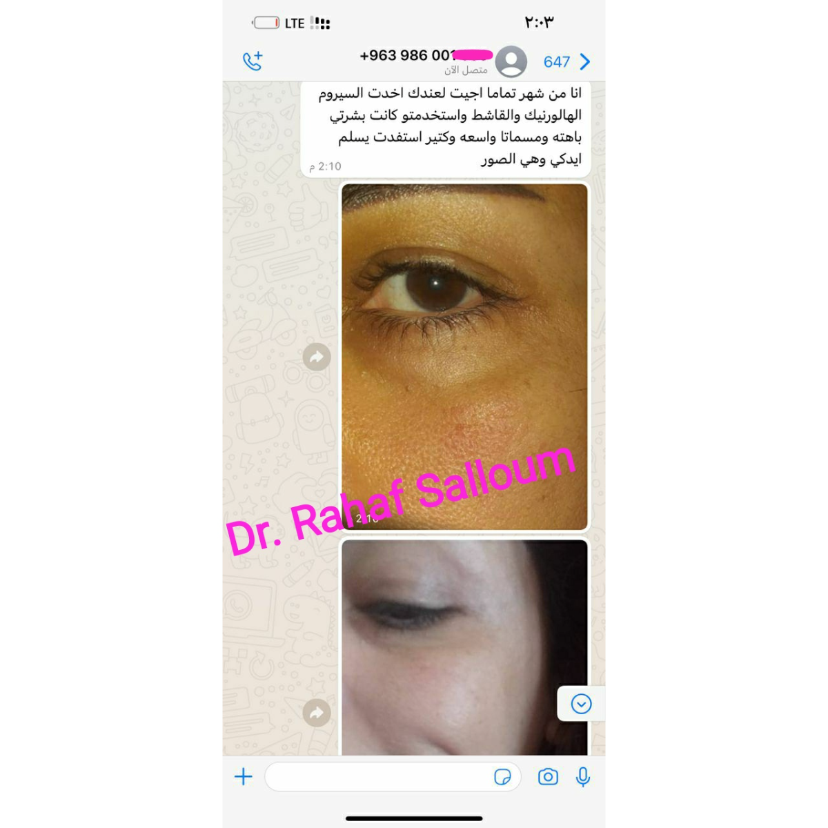 product img