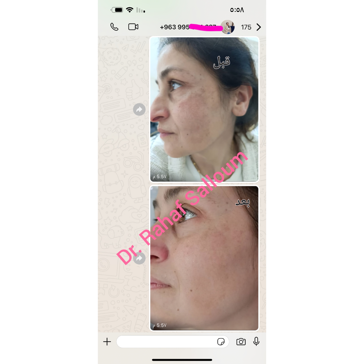 product img