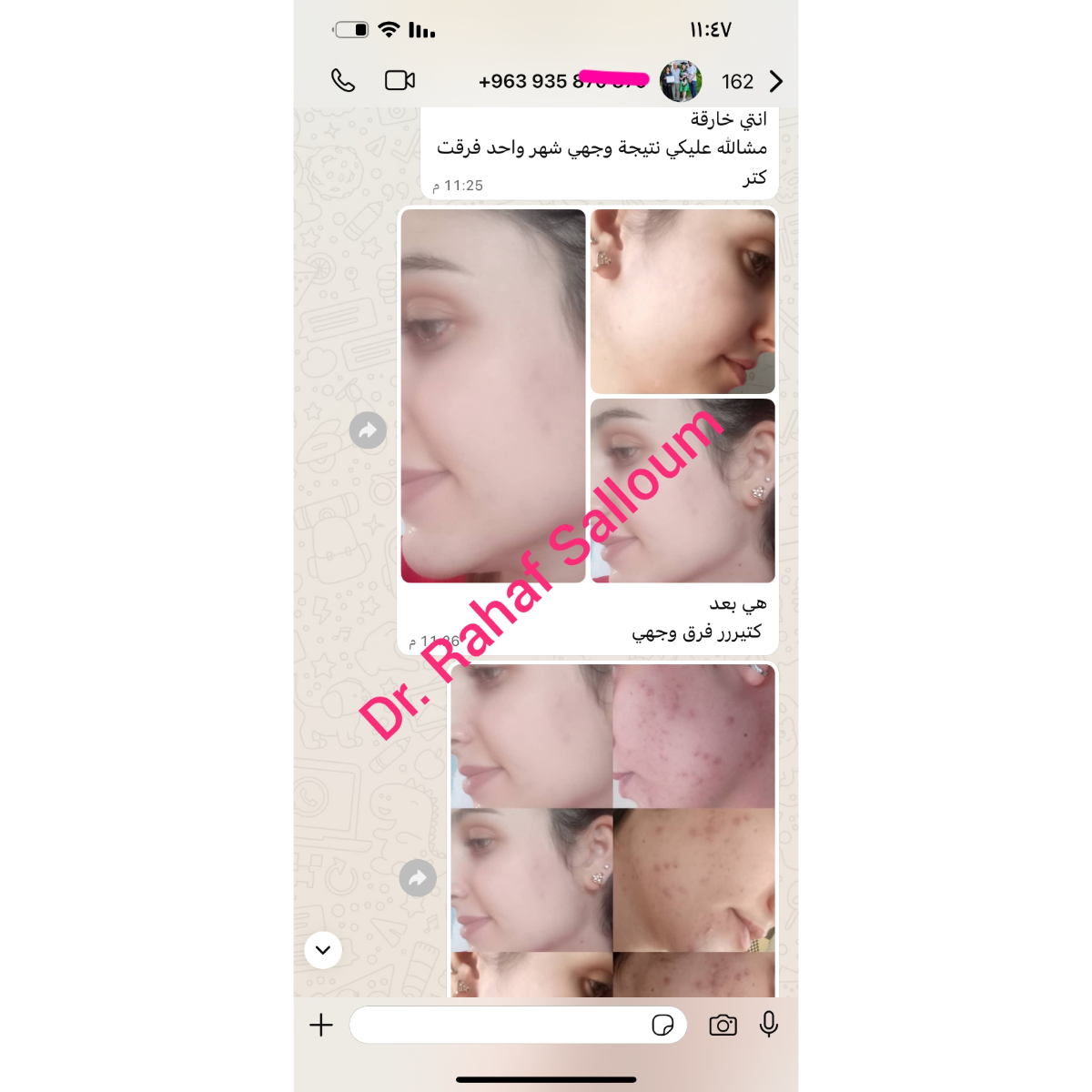 product img