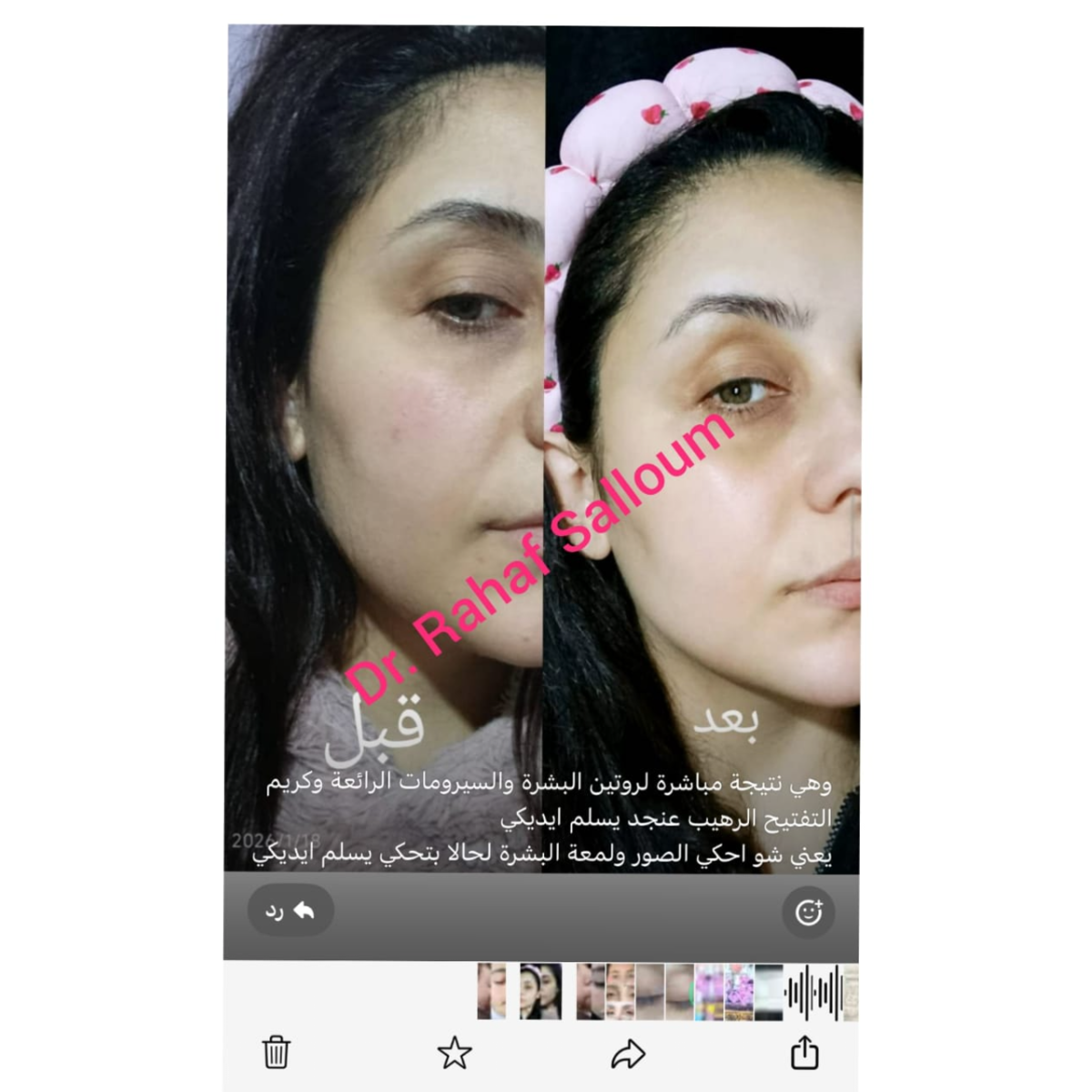 product img